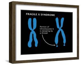 Fragile X Syndrome-Monica Schroeder-Framed Giclee Print