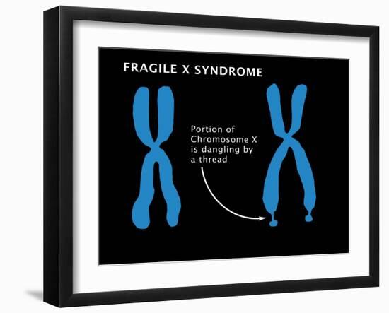 Fragile X Syndrome-Monica Schroeder-Framed Giclee Print