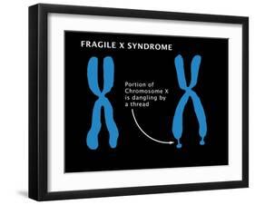 Fragile X Syndrome-Monica Schroeder-Framed Giclee Print