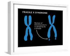 Fragile X Syndrome-Monica Schroeder-Framed Giclee Print