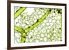 Freshwater Alga, Light Micrograph-Dr. Keith Wheeler-Framed Photographic Print