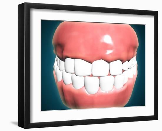 Front View of Human Mouth with Teeth and Gums-null-Framed Art Print