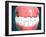 Front View of Human Mouth with Teeth and Gums-null-Framed Art Print