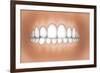 Front View of Teeth Showing Healthy Gums-null-Framed Art Print