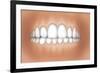 Front View of Teeth Showing Healthy Gums-null-Framed Art Print