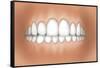 Front View of Teeth Showing Healthy Gums-null-Framed Stretched Canvas