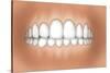 Front View of Teeth Showing Healthy Gums-null-Stretched Canvas