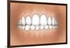 Front View of Teeth Showing Healthy Gums-null-Framed Art Print