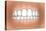 Front View of Teeth Showing Healthy Gums-null-Stretched Canvas