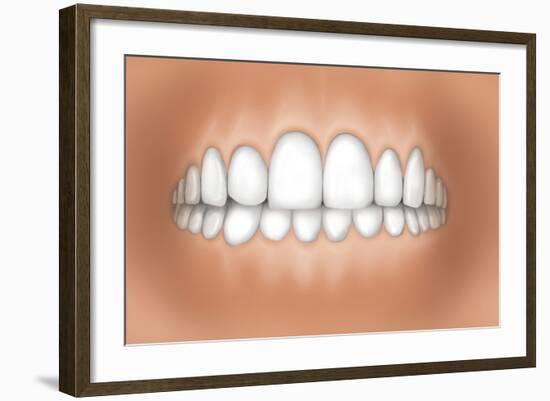Front View of Teeth Showing Healthy Gums-null-Framed Art Print