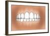 Front View of Teeth Showing Healthy Gums-null-Framed Art Print