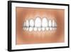 Front View of Teeth Showing Healthy Gums-null-Framed Art Print