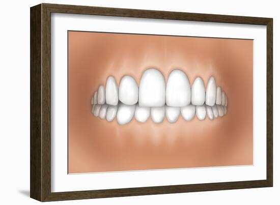 Front View of Teeth Showing Healthy Gums-null-Framed Art Print