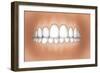 Front View of Teeth Showing Healthy Gums-null-Framed Art Print