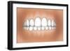 Front View of Teeth Showing Healthy Gums-null-Framed Art Print