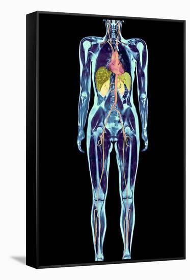 Full Body Scan, MRI Scan-Volker Steger-Framed Stretched Canvas
