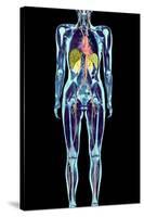 Full Body Scan, MRI Scan-Volker Steger-Stretched Canvas