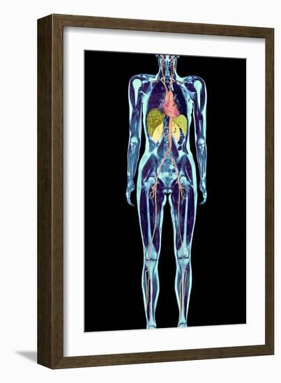 Full Body Scan, MRI Scan-Volker Steger-Framed Photographic Print