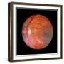 Fundus Camera Image of a Normal Retina, Caucasian-Rory McClenaghan-Framed Premium Photographic Print