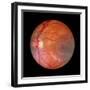 Fundus Camera Image of a Normal Retina, Caucasian-Rory McClenaghan-Framed Premium Photographic Print