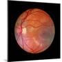Fundus Camera Image of a Normal Retina, Caucasian-Rory McClenaghan-Mounted Premium Photographic Print