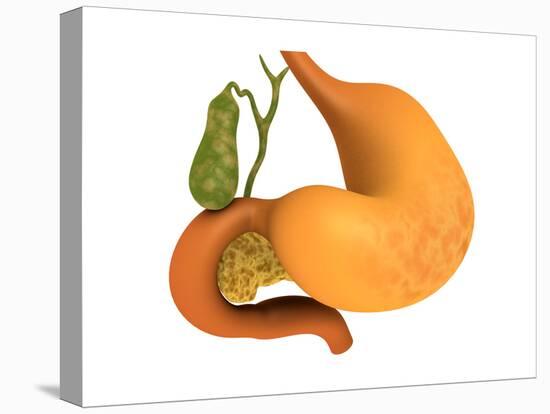 Gall Bladder with Stomach-null-Stretched Canvas
