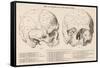 Gall's Phrenological System - the Skull Seen from Side and Front-null-Framed Stretched Canvas