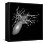 Gallbladder And Biliary Tree, 3D MRI-Du Cane Medical-Framed Stretched Canvas