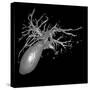 Gallbladder And Biliary Tree, 3D MRI-Du Cane Medical-Stretched Canvas