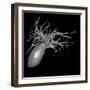 Gallbladder And Biliary Tree, 3D MRI-Du Cane Medical-Framed Photographic Print