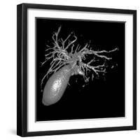 Gallbladder And Biliary Tree, 3D MRI-Du Cane Medical-Framed Photographic Print