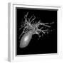 Gallbladder And Biliary Tree, 3D MRI-Du Cane Medical-Framed Photographic Print