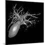 Gallbladder And Biliary Tree, 3D MRI-Du Cane Medical-Mounted Photographic Print