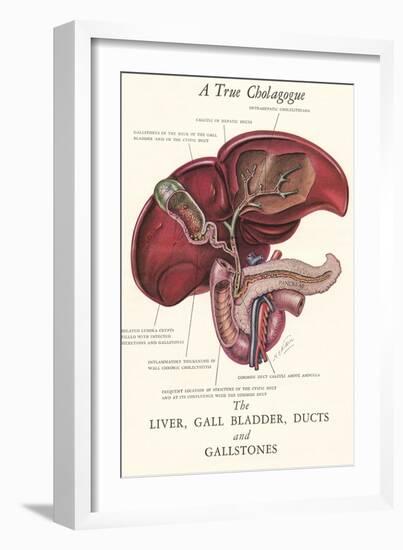 Gallbladder Cross-Section-null-Framed Art Print