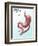 Gastric Bypass Surgery-Gwen Shockey-Framed Giclee Print