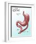 Gastric Bypass Surgery-Gwen Shockey-Framed Giclee Print