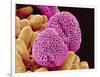 Geranium Pollen-Micro Discovery-Framed Photographic Print