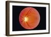 Glaucoma-Paul Parker-Framed Photographic Print