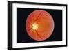 Glaucoma-Paul Parker-Framed Photographic Print