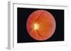 Glaucoma-Paul Parker-Framed Photographic Print