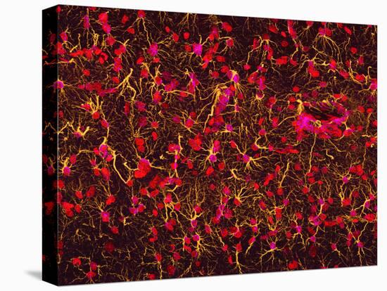 Glial Cells-Thomas Deerinck-Stretched Canvas