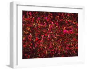 Glial Cells-Thomas Deerinck-Framed Photographic Print