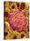 Glomerulus from Rat Kidney-Micro Discovery-Stretched Canvas