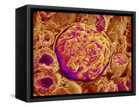 Glomerulus of kidney-Micro Discovery-Framed Stretched Canvas