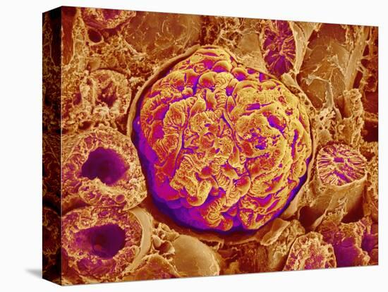 Glomerulus of kidney-Micro Discovery-Stretched Canvas