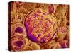 Glomerulus of kidney-Micro Discovery-Stretched Canvas