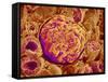 Glomerulus of kidney-Micro Discovery-Framed Stretched Canvas