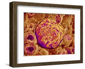 Glomerulus of kidney-Micro Discovery-Framed Photographic Print