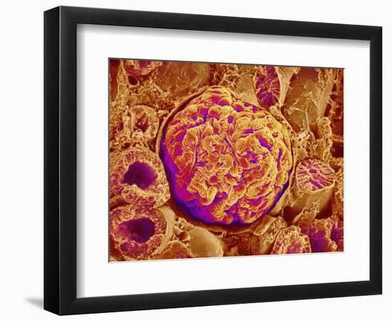 Glomerulus of kidney-Micro Discovery-Framed Photographic Print