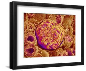 Glomerulus of kidney-Micro Discovery-Framed Photographic Print